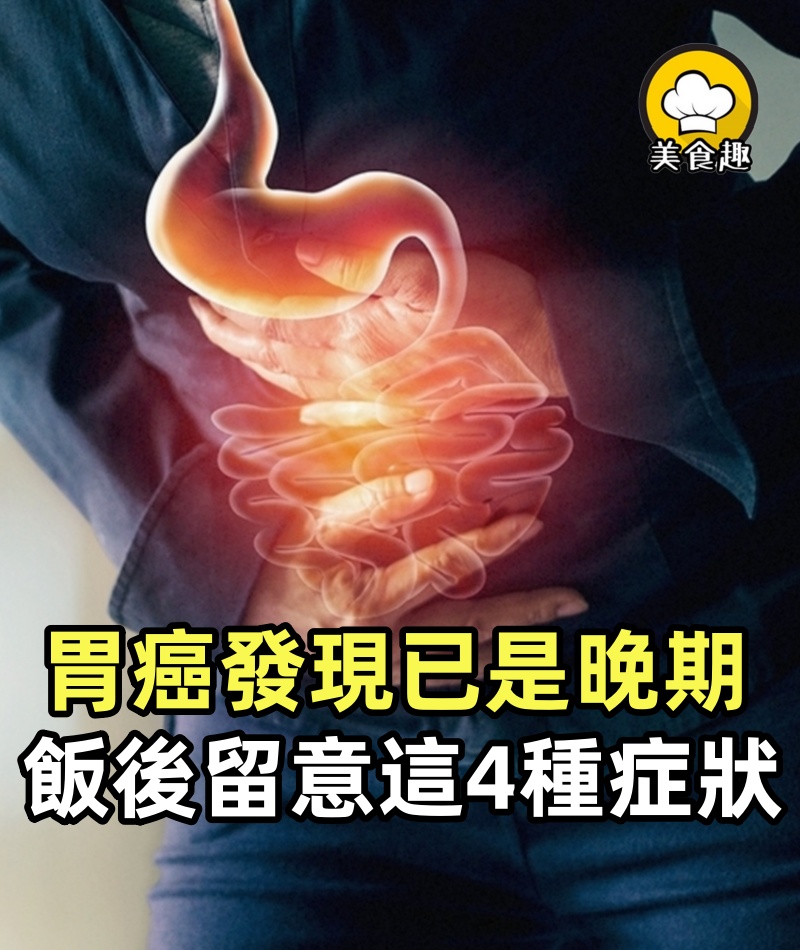 胃癌不痛不癢,發現已是晚期,飯後留意這4種症狀,關鍵時刻能救命!!